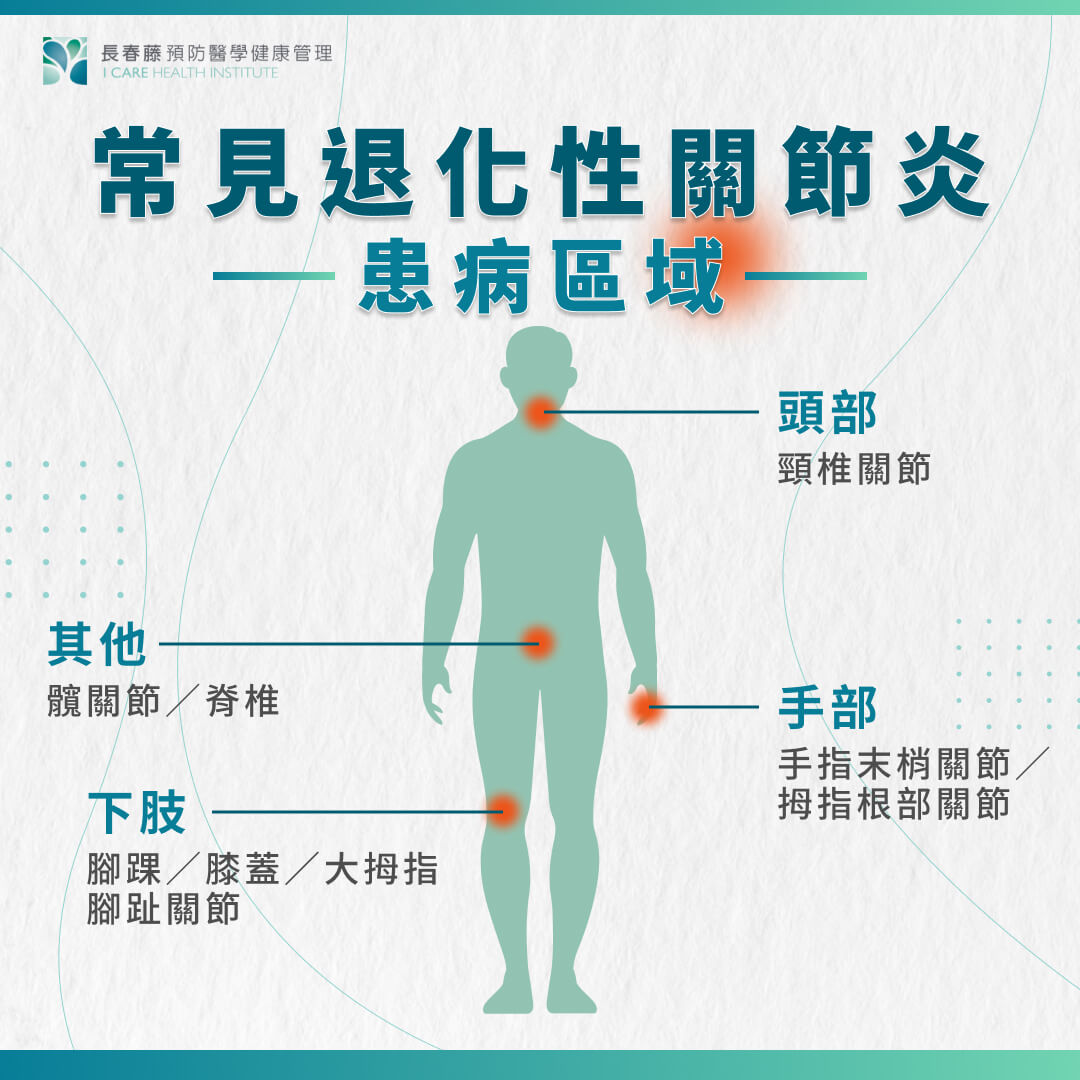 常見的退化性關節炎患病區域